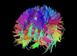 Play with the brain: An online game that’s helping map the connections of the retina