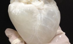 A ghost heart?